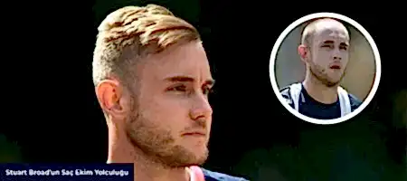 Stuart-Broad-Before-After