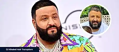 DJ-Khaled-Before-After