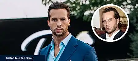 Tristan-Tate-Saç-Ekimi-Önce-Sonra