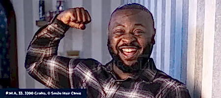 Afro-Hair-Transplant-02-1