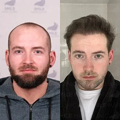 4900 Grafts - C. DOWLING