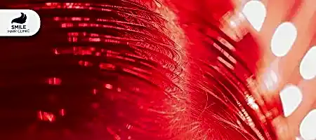 Kırmızı-Işık-Tedavisi-ve-Saç--Dökülmesi