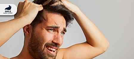 Saç-Dökülmesi-ve-Dihidrotestosteron-(DHT)