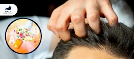 Saç-Dökülmesine-Karşı-En-İyi-Vitamini-Nasıl-Seçersiniz