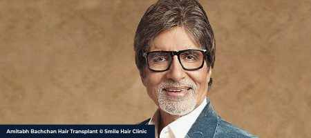 Amitabh-Bachchan-Hair-Transplant-02