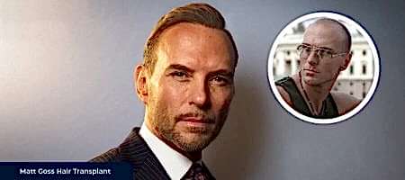 Before-After-Matt-Goss
