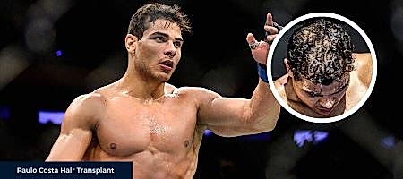 Before-After-Paulo-Costa