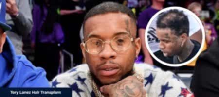 Before-After-Tory-Lanez