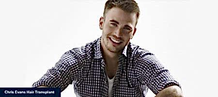 Chris-Evans-Hair-Transplant-2
