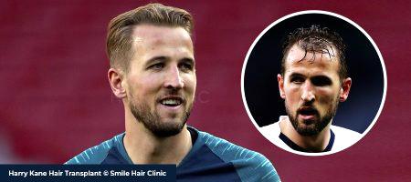 Harry-Kane-Header