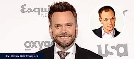 Joel-McHale-Before-After