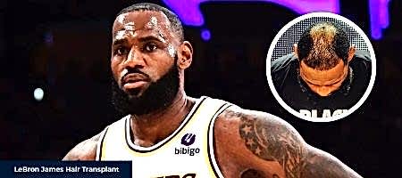 LeBron-James-Before-After