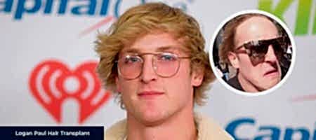 Logan-Paul-Before-After