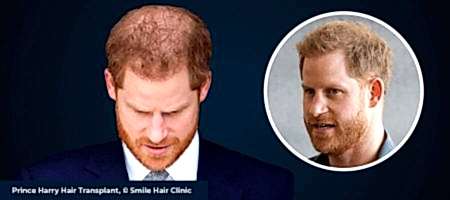 Prince-Harry-03-Header-1