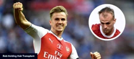 ROB-HOLDING-HAIR-TRANSPLANT-1