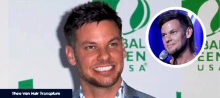 Theo-Von-Before-After