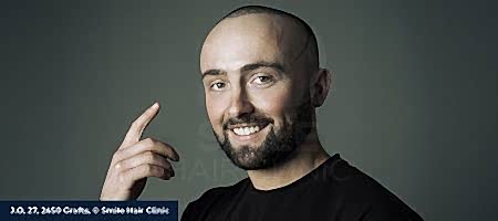 Why-to-choose-Smile-02