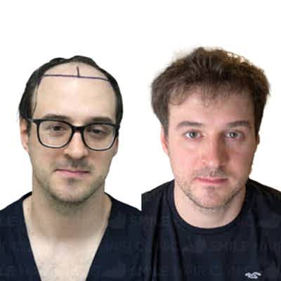 4750 Grafts - RAFAL SIEKANSKI