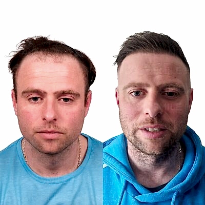 4750 Grafts - WILLIAM COCHRANE