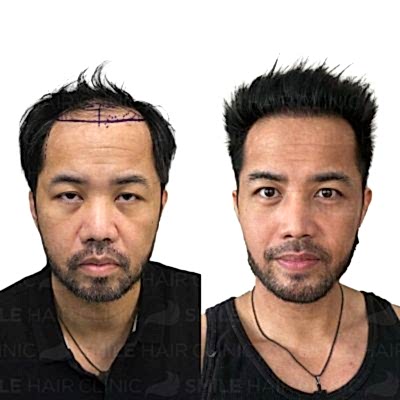 4850 Grafts - RICHARD SOLNES