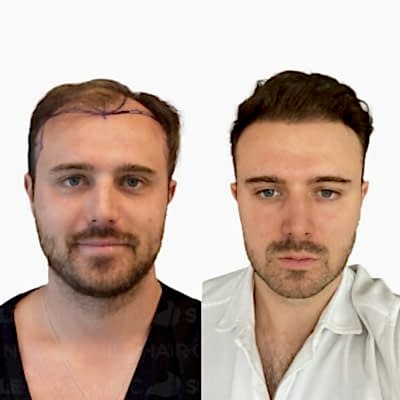 5400 Grafts - RAZVAN PRICOPE