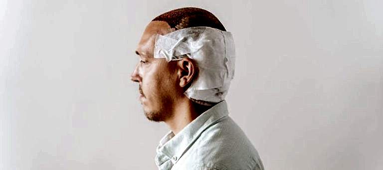 Smile Hair Clinic’te Sterilizasyon ve Hijyen Standartları