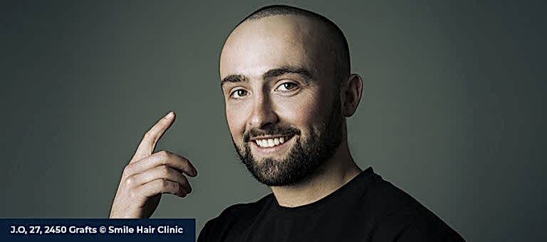 Neden Smile Hair Clinic? 1 Neden Smile Hair Clinic?